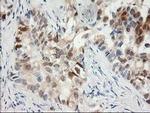 15-PGDH Antibody in Immunohistochemistry (Paraffin) (IHC (P))