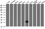 15-PGDH Antibody in Western Blot (WB)