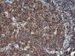 VASP Antibody in Immunohistochemistry (Paraffin) (IHC (P))