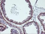 VASP Antibody in Immunohistochemistry (Paraffin) (IHC (P))