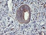 VASP Antibody in Immunohistochemistry (Paraffin) (IHC (P))