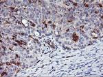 VASP Antibody in Immunohistochemistry (Paraffin) (IHC (P))