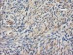 UBA2 Antibody in Immunohistochemistry (Paraffin) (IHC (P))