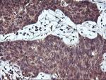 HDHD1 Antibody in Immunohistochemistry (Paraffin) (IHC (P))