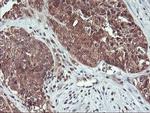 HDHD1 Antibody in Immunohistochemistry (Paraffin) (IHC (P))