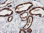 NNMT Antibody in Immunohistochemistry (Paraffin) (IHC (P))