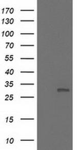 NNMT Antibody in Western Blot (WB)