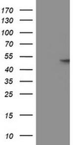 GBA3 Antibody in Western Blot (WB)