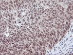 POLR2E Antibody in Immunohistochemistry (Paraffin) (IHC (P))