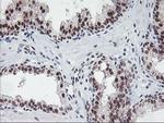 POLR2E Antibody in Immunohistochemistry (Paraffin) (IHC (P))