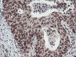 POLR2E Antibody in Immunohistochemistry (Paraffin) (IHC (P))