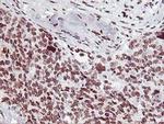 HOXC11 Antibody in Immunohistochemistry (Paraffin) (IHC (P))