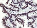 HOXC11 Antibody in Immunohistochemistry (Paraffin) (IHC (P))