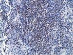 HOXC11 Antibody in Immunohistochemistry (Paraffin) (IHC (P))