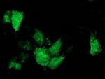 ARFGAP1 Antibody in Immunocytochemistry (ICC/IF)