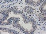 ARFGAP1 Antibody in Immunohistochemistry (Paraffin) (IHC (P))