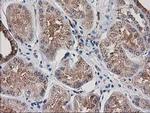 ARFGAP1 Antibody in Immunohistochemistry (Paraffin) (IHC (P))