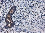 ARFGAP1 Antibody in Immunohistochemistry (Paraffin) (IHC (P))