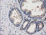 ARFGAP1 Antibody in Immunohistochemistry (Paraffin) (IHC (P))