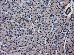 ARFGAP1 Antibody in Immunohistochemistry (Paraffin) (IHC (P))