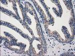 ARFGAP1 Antibody in Immunohistochemistry (Paraffin) (IHC (P))