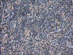 ARFGAP1 Antibody in Immunohistochemistry (Paraffin) (IHC (P))