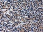 ARFGAP1 Antibody in Immunohistochemistry (Paraffin) (IHC (P))