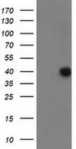 ANKRD53 Antibody in Western Blot (WB)