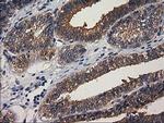 GBA3 Antibody in Immunohistochemistry (Paraffin) (IHC (P))