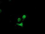 Destrin Antibody in Immunocytochemistry (ICC/IF)