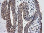 Destrin Antibody in Immunohistochemistry (Paraffin) (IHC (P))