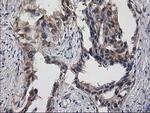 Destrin Antibody in Immunohistochemistry (Paraffin) (IHC (P))