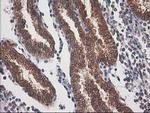 Destrin Antibody in Immunohistochemistry (Paraffin) (IHC (P))