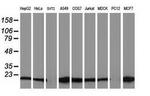 Destrin Antibody in Western Blot (WB)