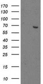 OGFOD1 Antibody in Western Blot (WB)