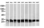 HDHD1 Antibody in Western Blot (WB)