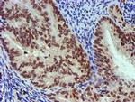 NNMT Antibody in Immunohistochemistry (Paraffin) (IHC (P))