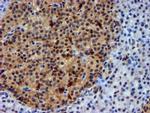 NNMT Antibody in Immunohistochemistry (Paraffin) (IHC (P))