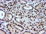 NNMT Antibody in Immunohistochemistry (Paraffin) (IHC (P))