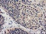 MEF2C Antibody in Immunohistochemistry (Paraffin) (IHC (P))