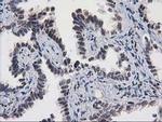 MEF2C Antibody in Immunohistochemistry (Paraffin) (IHC (P))