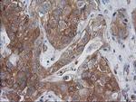 VASP Antibody in Immunohistochemistry (Paraffin) (IHC (P))