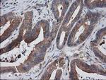 VASP Antibody in Immunohistochemistry (Paraffin) (IHC (P))