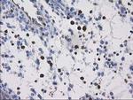 VASP Antibody in Immunohistochemistry (Paraffin) (IHC (P))