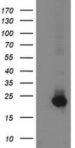 GUK1 Antibody in Western Blot (WB)