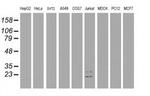 GUK1 Antibody in Western Blot (WB)