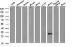 HAND1 Antibody in Western Blot (WB)