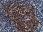 DCK Antibody in Immunohistochemistry (Paraffin) (IHC (P))