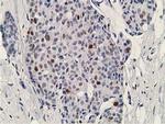 DCK Antibody in Immunohistochemistry (Paraffin) (IHC (P))