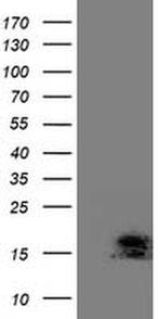 ECRG4 Antibody in Western Blot (WB)